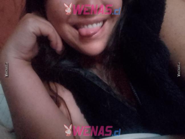 Madurita oral intenso normal 